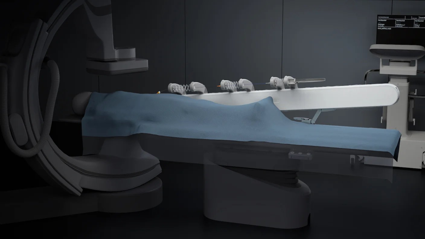 In Wild Experiment, Surgeon Uses Robot to Remove Blood Clot in Brain 4,000 Miles Away