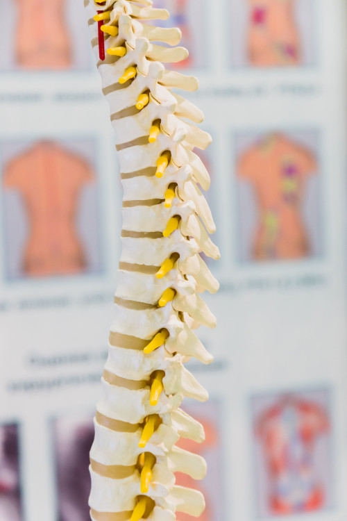 Alternatives to a Spinal Fusion Dr. Stefano Sinicropi