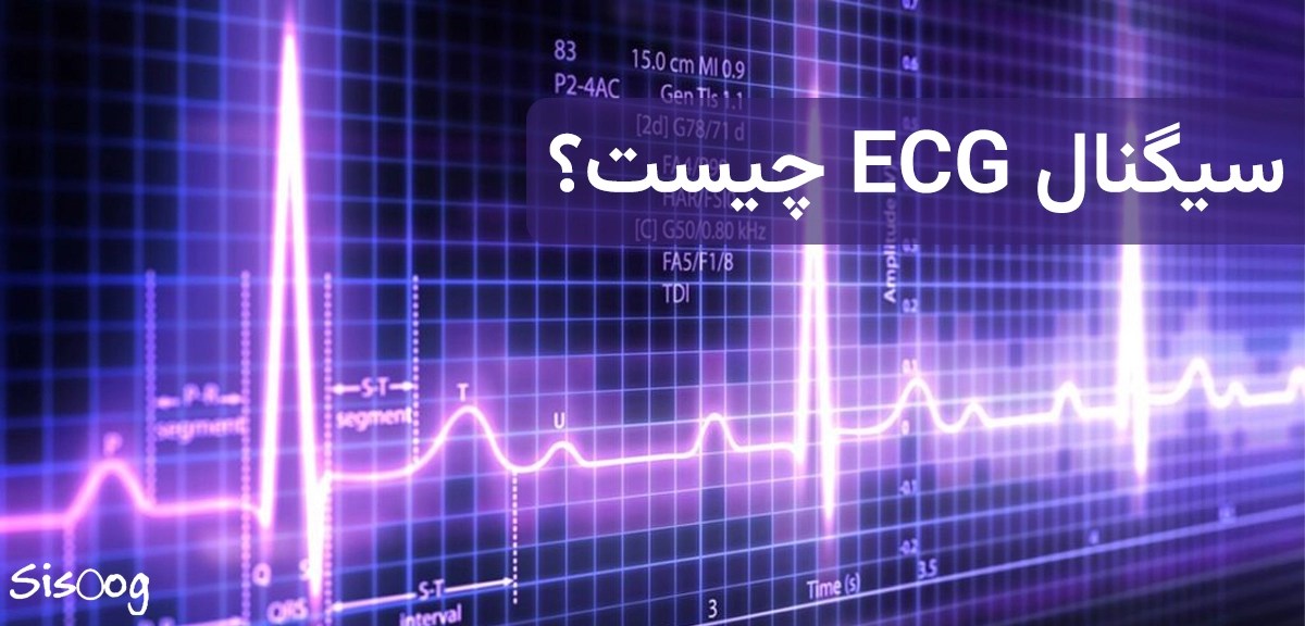 الکتروکاردیوگرام یا سیگنال ecg چیست؟ سیسوگ
