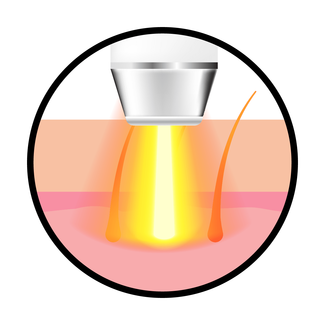 Laser Hair Removal is it right for you? SJH Derm