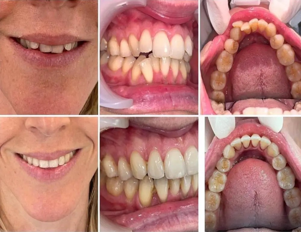 Orthodontic Treatment in Dubai, UAE Orthodontist in Dubai Skin111