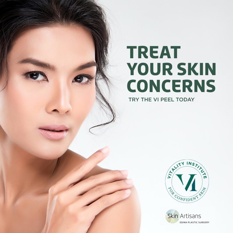 Reveal a Clearer, Smoother & More Even Skin Tone with VI Peel! Skin