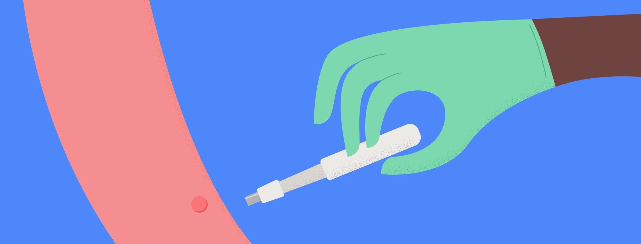 What should punch biopsy pigmentation look like?