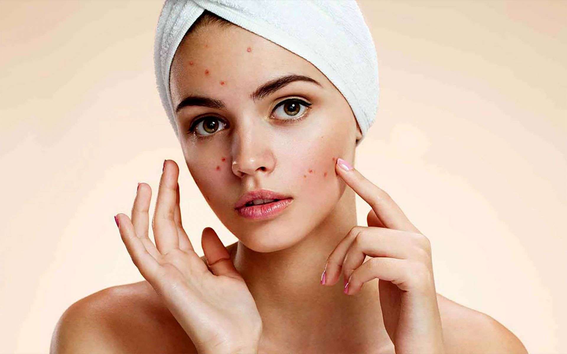 Acne & Scarring Treatment Skin Care Physicians