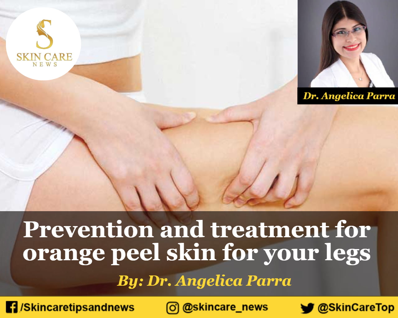 Prevention and treatment for orange peel skin for your legs