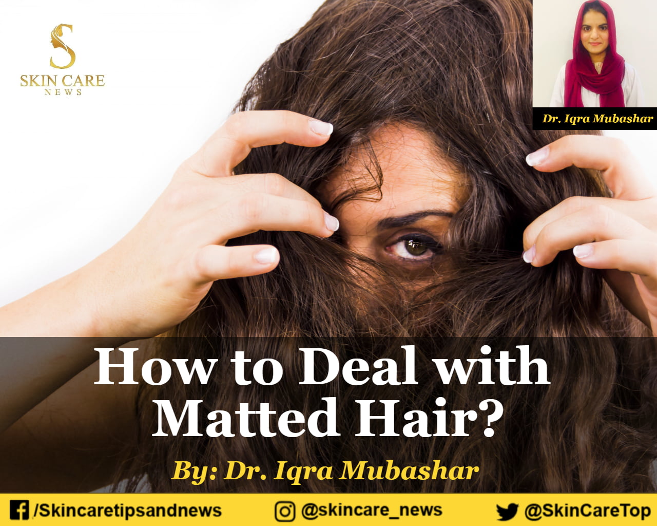 How to Deal with Matted Hair?