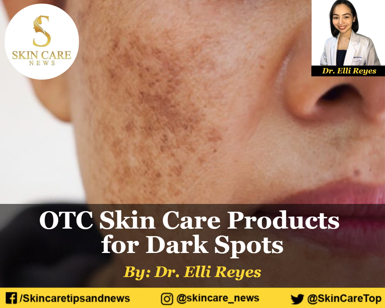 OTC Skin Care Products for Dark Spots