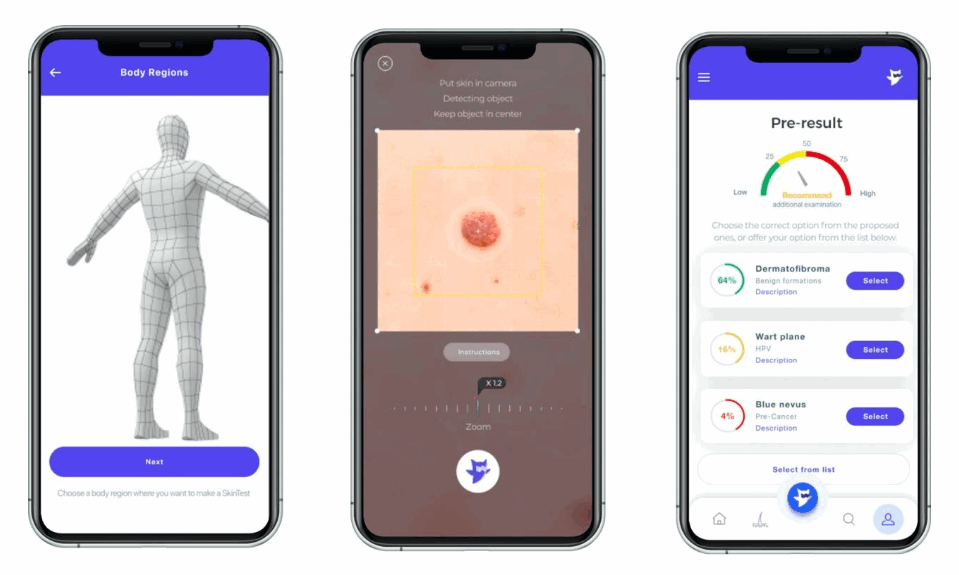 Mole mapping Online AI Dermatologist