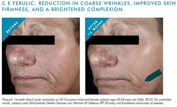 SkinCeuticals CE Ferulic Available Online at SkinMiles By Dr Alek