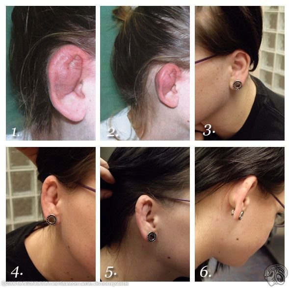 Shattered Cartilage Piercing Gun