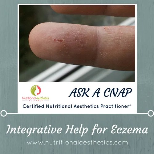 Is Toxic Mold Responsible for Your Skin Problems?