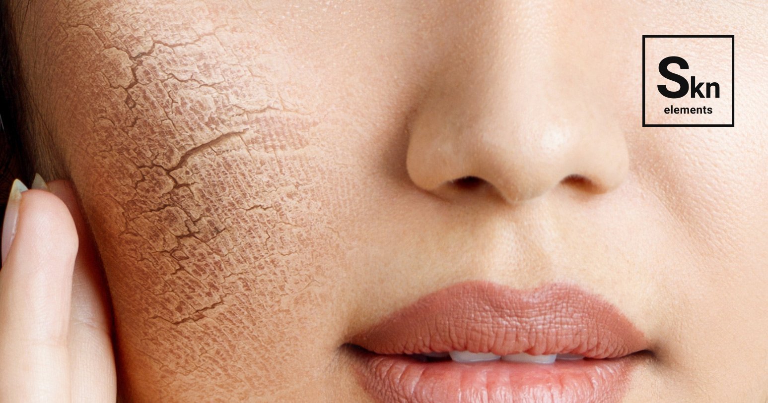 Is your skin dry or dehydrated…and what’s the difference? Skn Elements