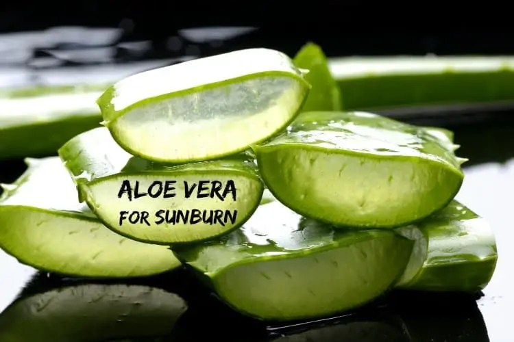 How to heal sunburn fast by using aloe vera gel