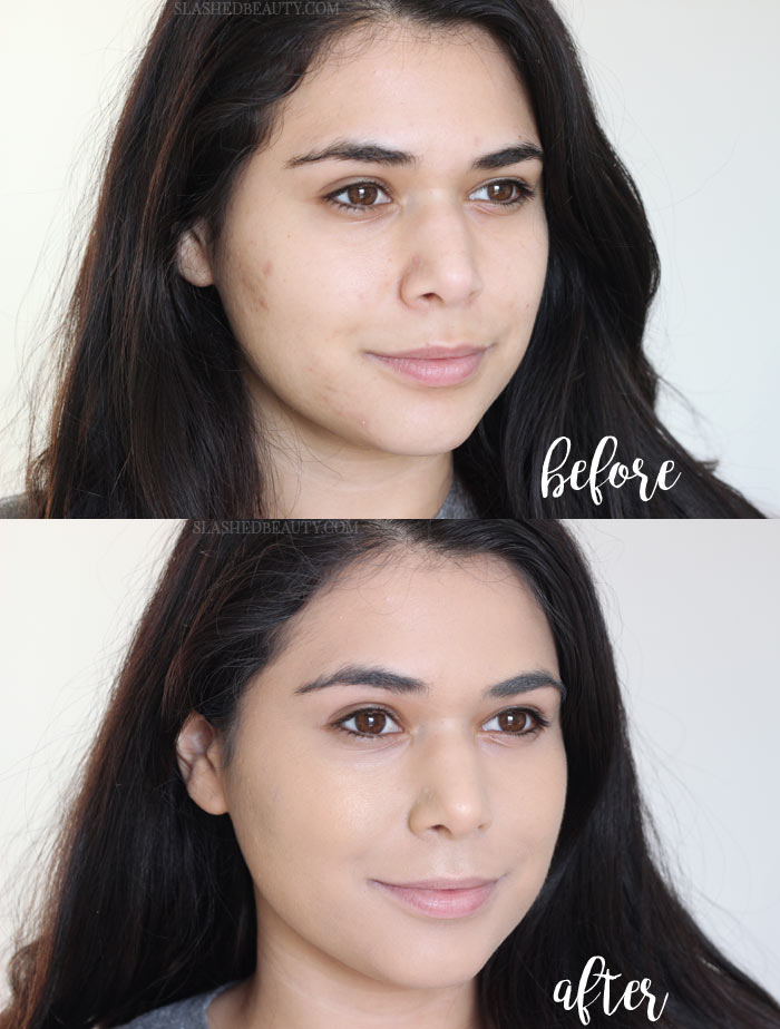 Acne Makeup Routine You Mugeek Vidalondon