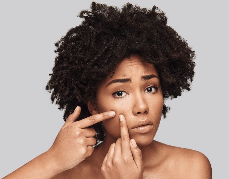 Cortisone Acne Injections Singapore Treat Cystic Acne Quickly