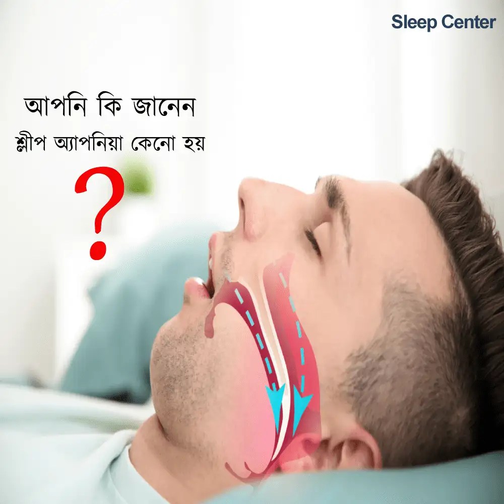 Sleep specialist in bangladesh Sleep Center BD
