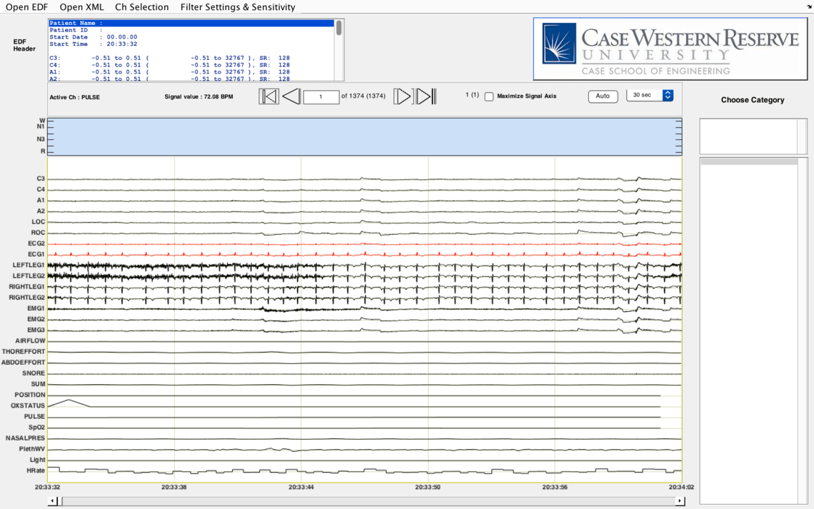edf viewer - basic troubleshooting - Sleep Data - National Sleep