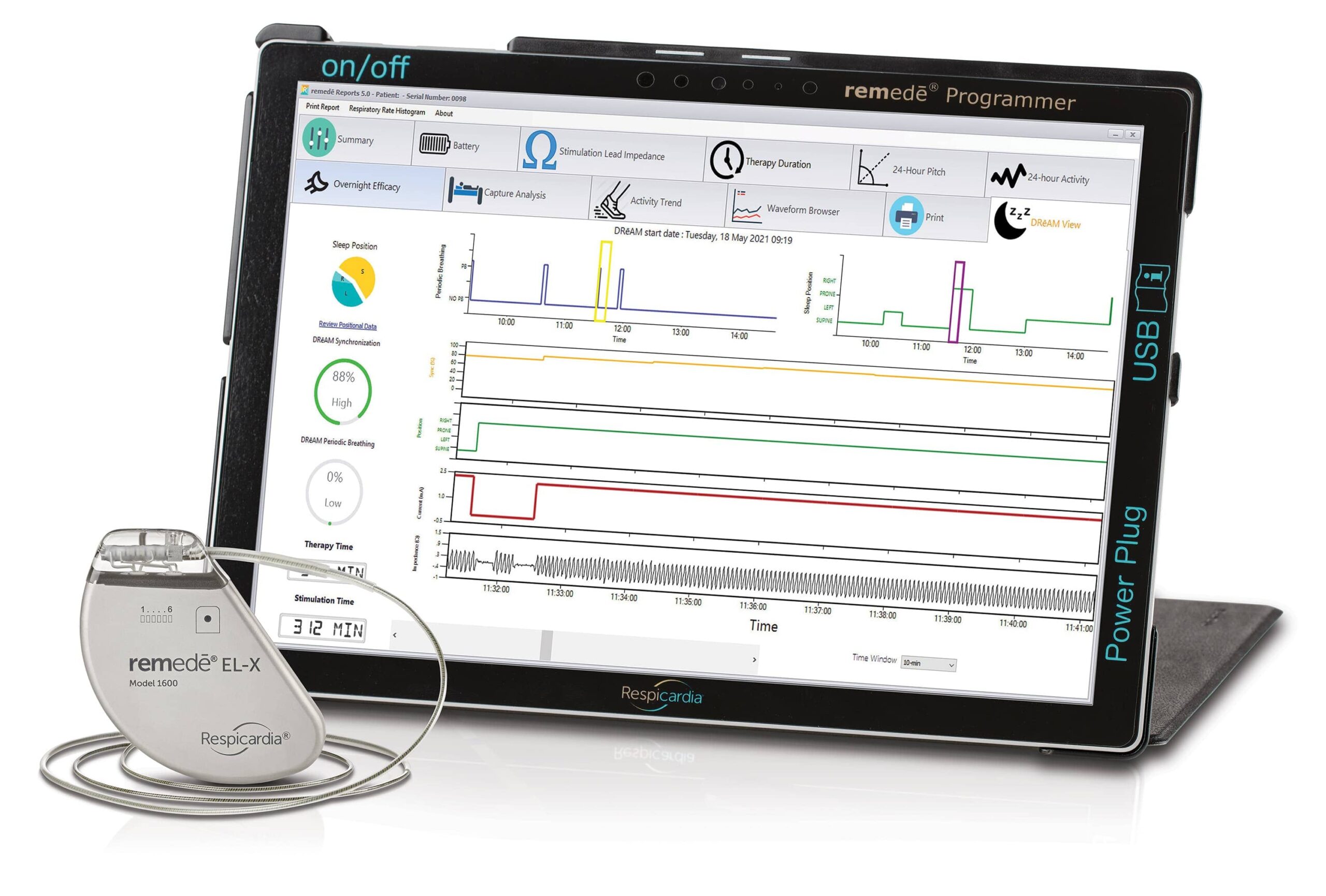 FDA Approves NextGen Remedē System for Central Sleep Apnea Sleep Review