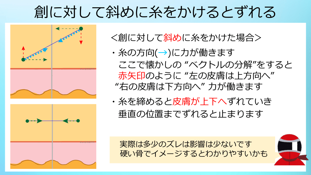 図解 縫合の基本 Part1 皮膚縫合 Antaa Slide