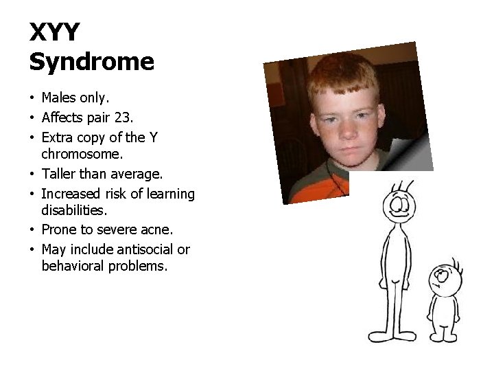 Xyy Syndrome