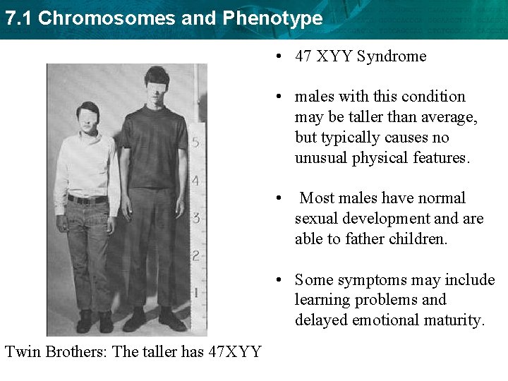 Xyy Syndrome What Happens To The Body