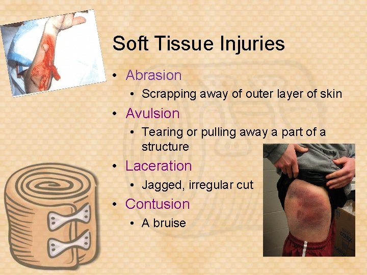 Unit 7 Injury Management Soft Tissue Injuries Abrasion