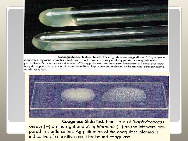 Bacteriology Practical MSS Module Catalase Test Catalase