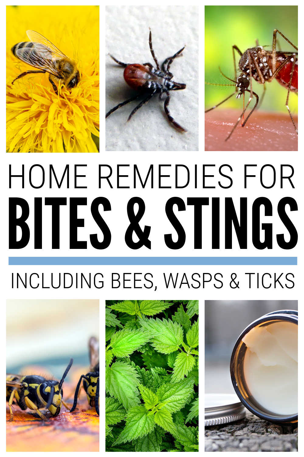 Home Remedies For Bites & Stings