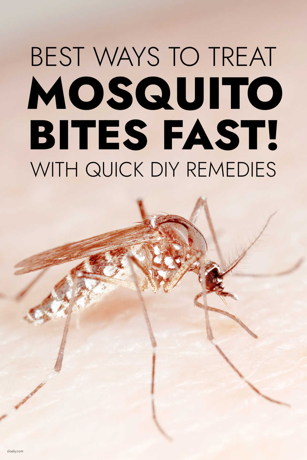 Mosquito Bite Remedies
