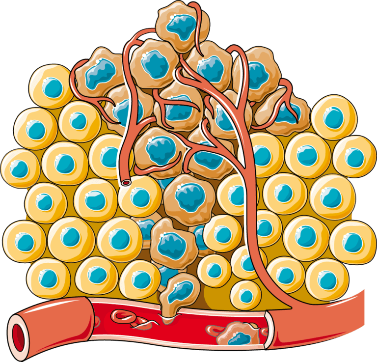 Cancerous cell Servier Medical Art