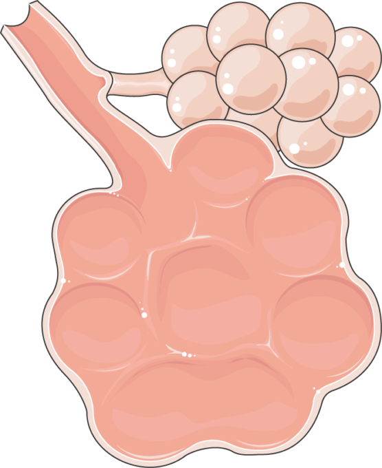 Emphysema Servier Medical Art