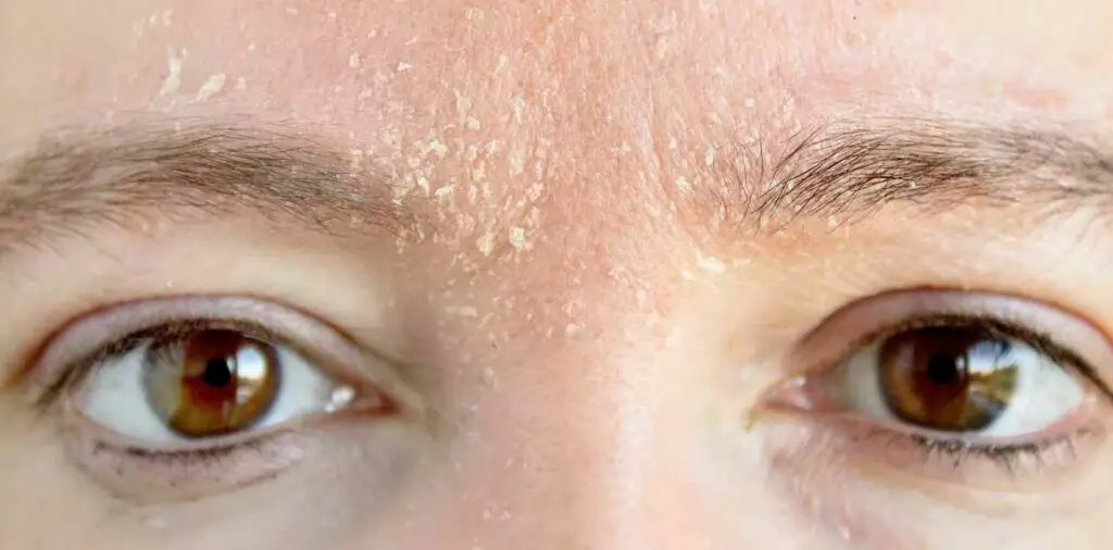 Can Air Conditioner Make You Tired? You Should Know Smart AC Solutions