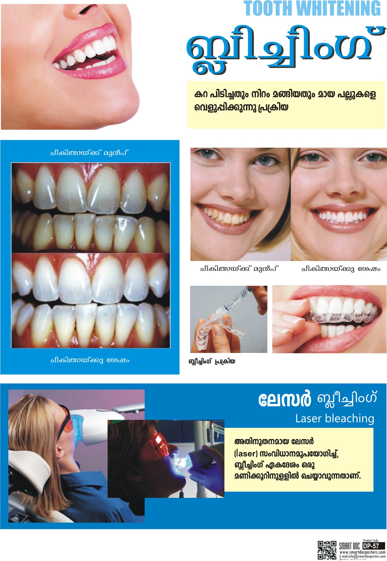 Dental Bleaching (Malayalam) DP57M Smart Doc Posters