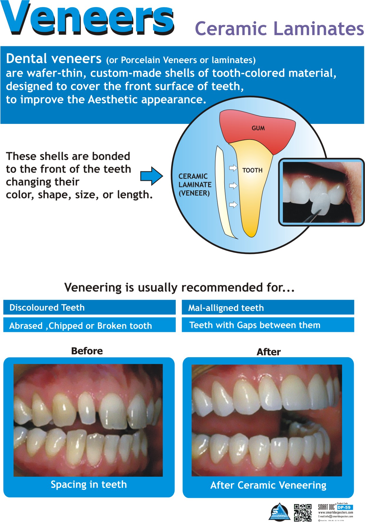 veneers (Eng.) DP59 E. Smart Doc Posters