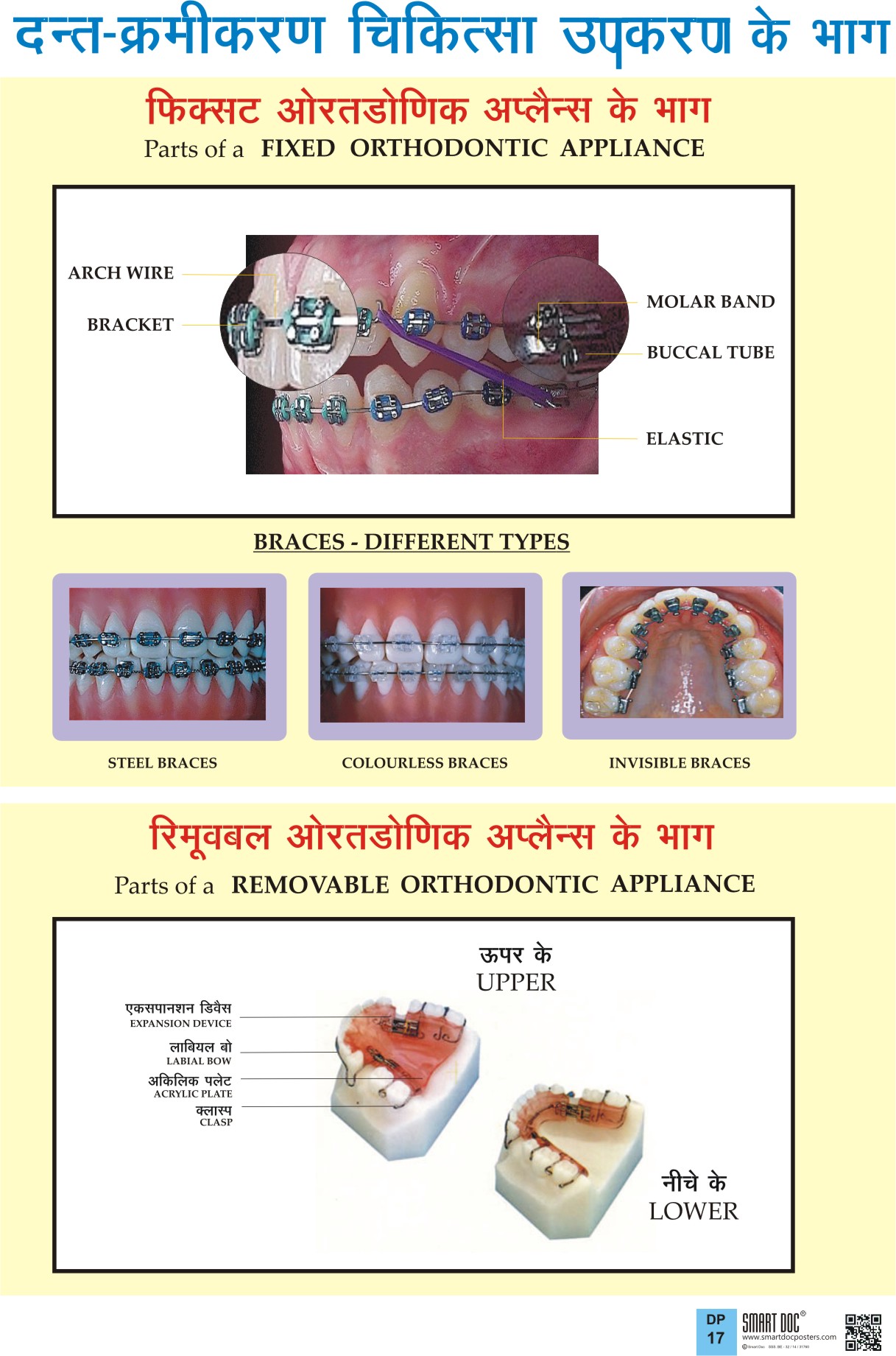 Parts of a fixed and removable orthodontic appliance (Hindi) DP17 H