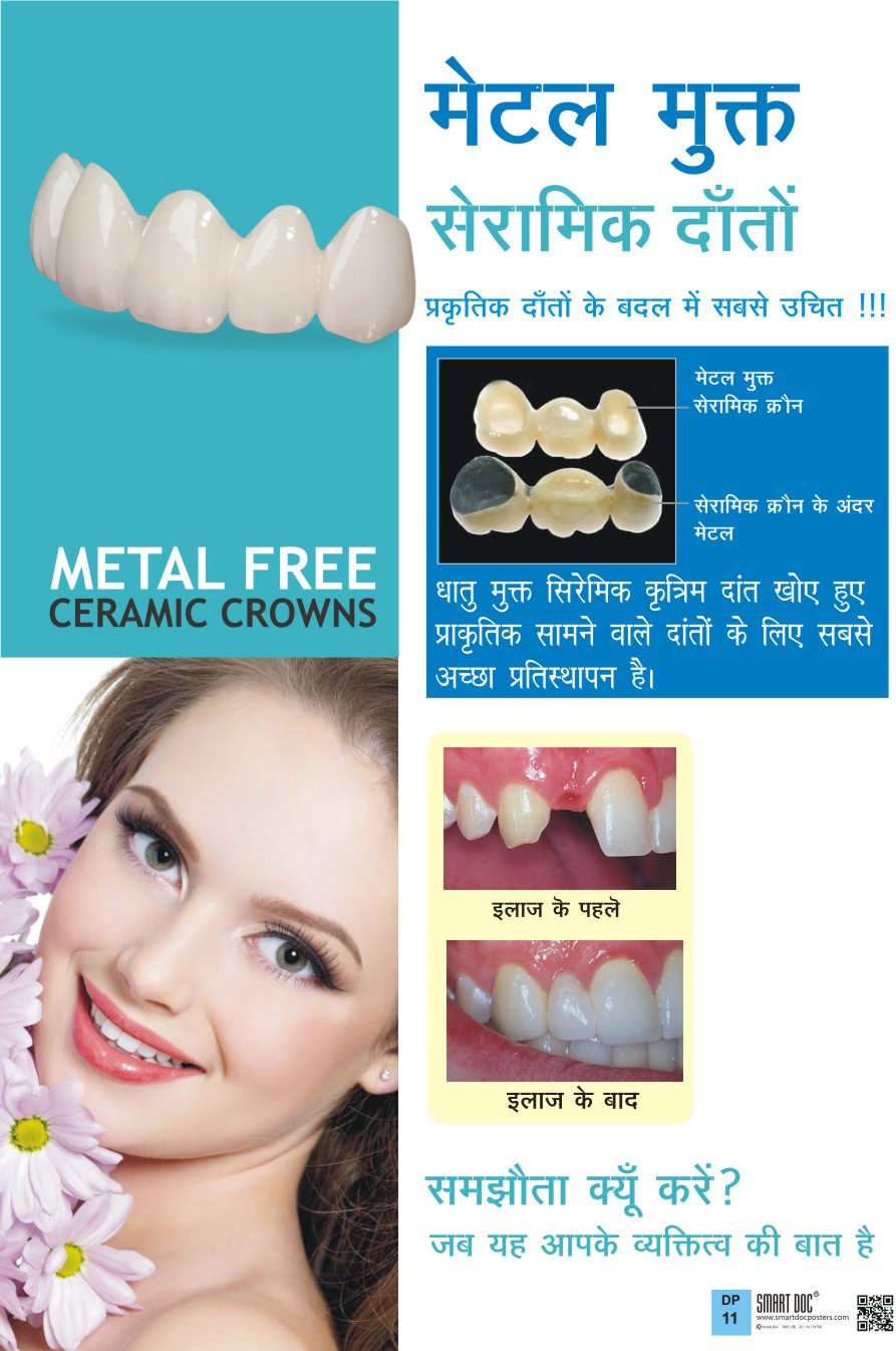 Metal free Ceramic Crowns (Hindi) DP11 H Smart Doc Posters
