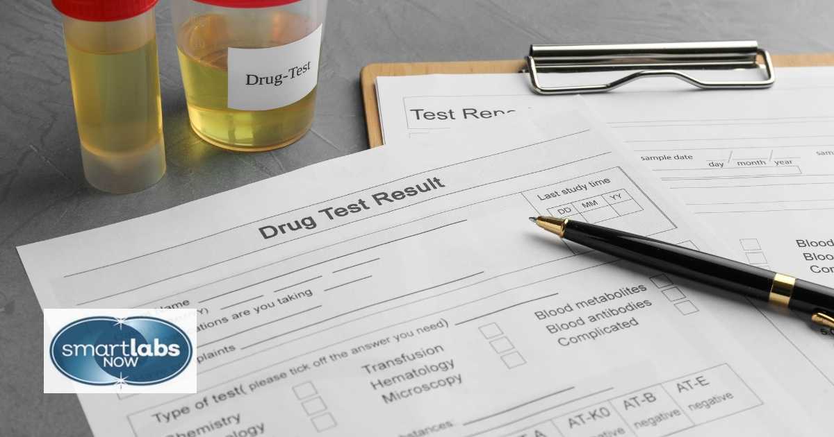 How Do You Know If You Passed A Preemployment Drug Test