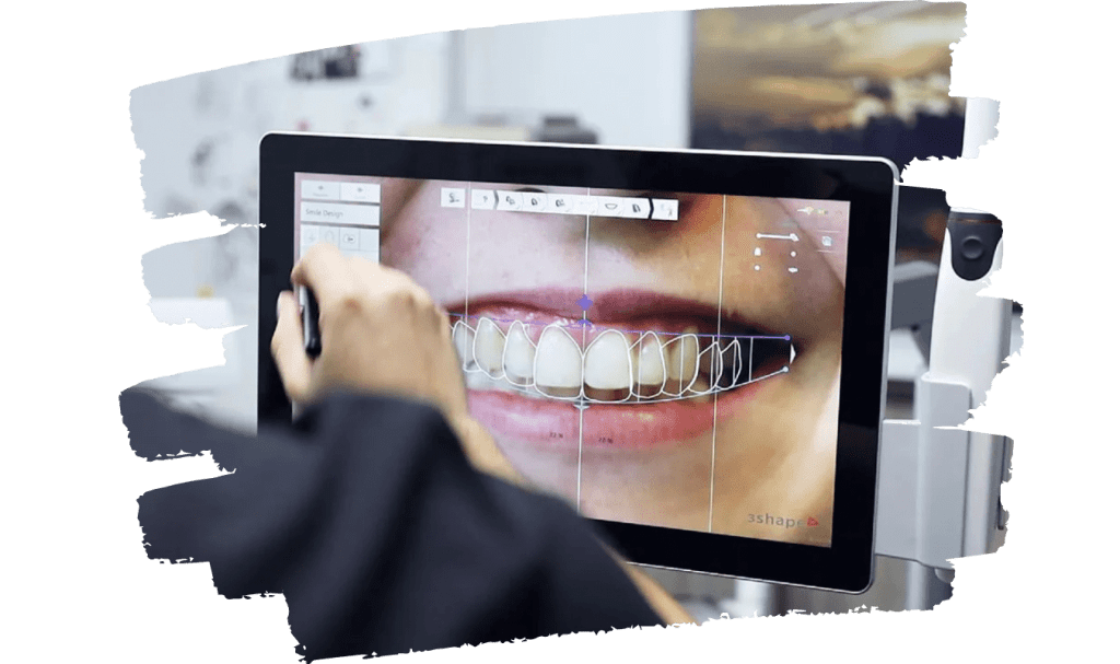 Custom AR Smile App for Dental Industry