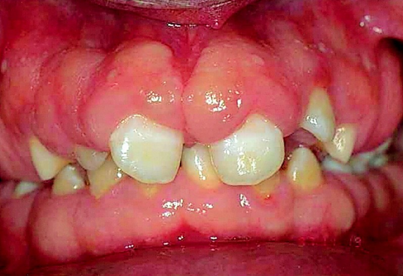 Diseases of the teeth and gums (ReelDx) Smarty PANCE