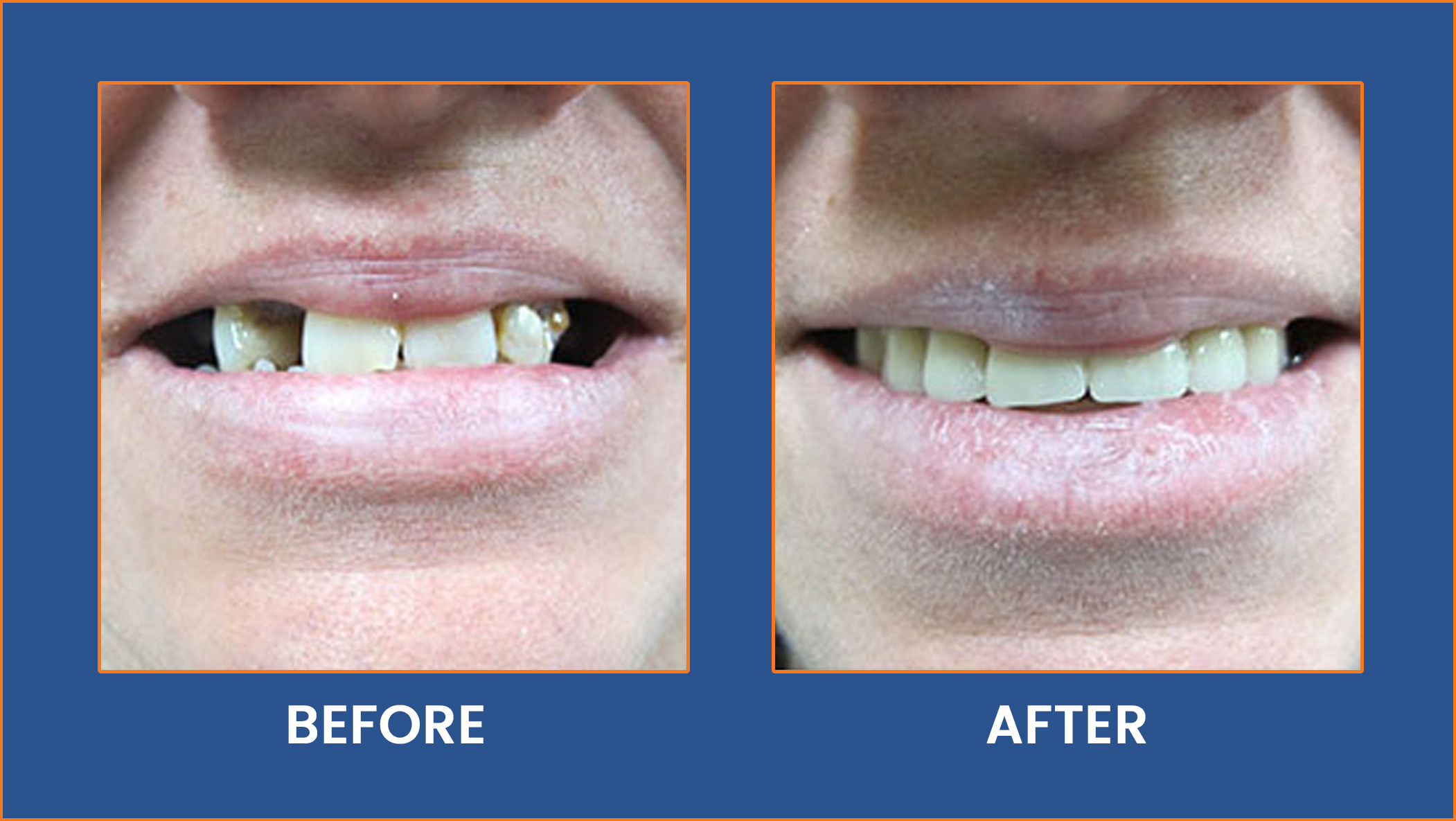 to the Online Home Of The Smile Center Dentist Buffalo NY