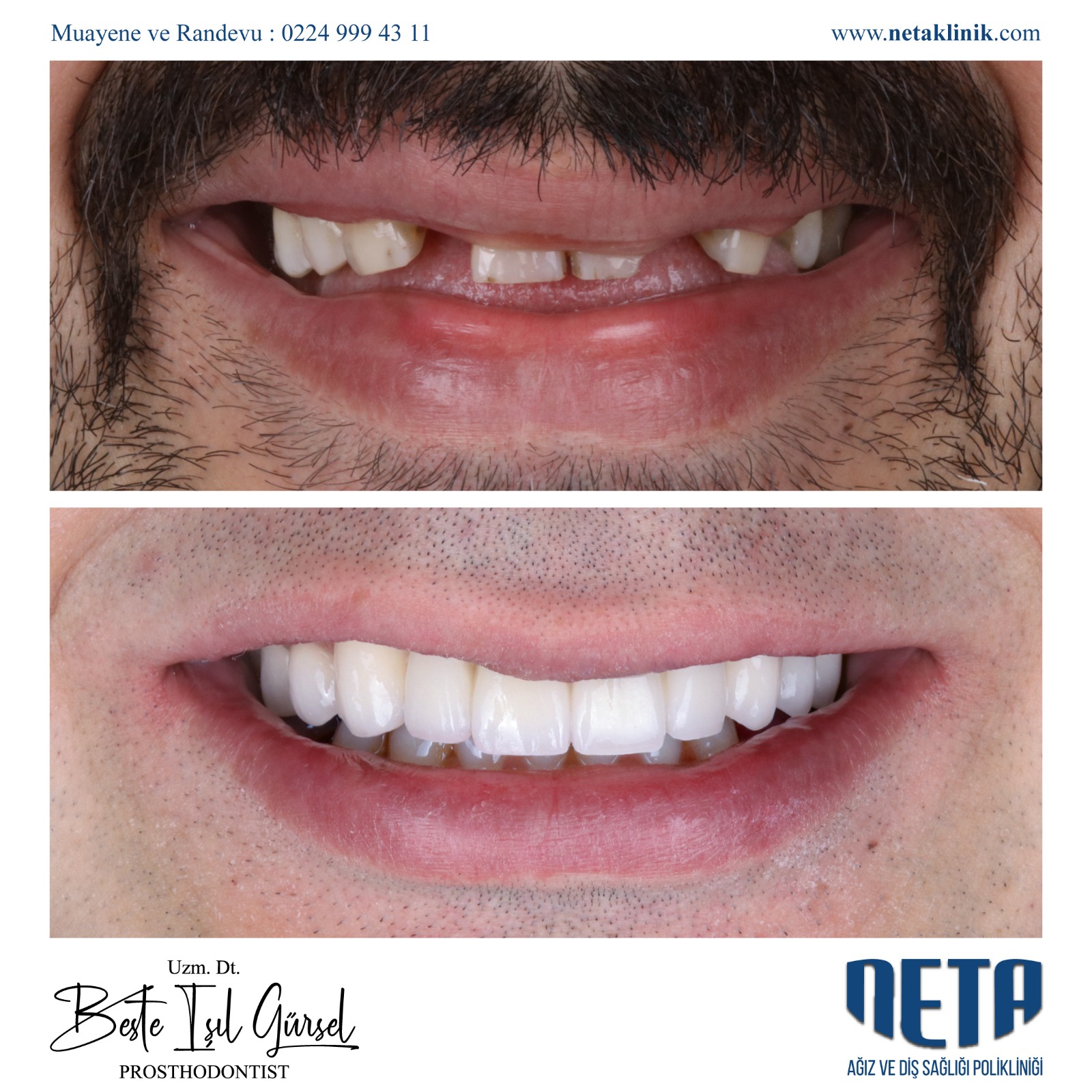 Gallery Smile Design Center