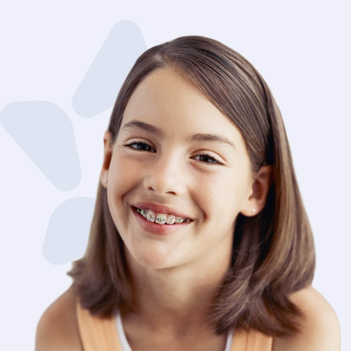 Braces Smile Doctors