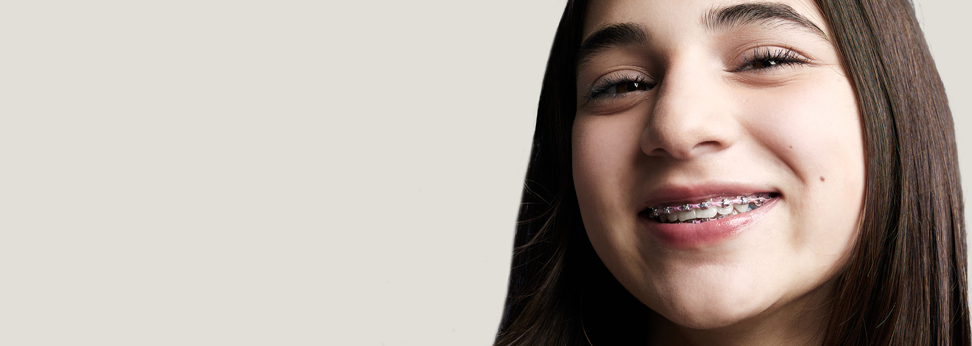 Braces for Adults, Kids, and Teens Metal and Clear Braces