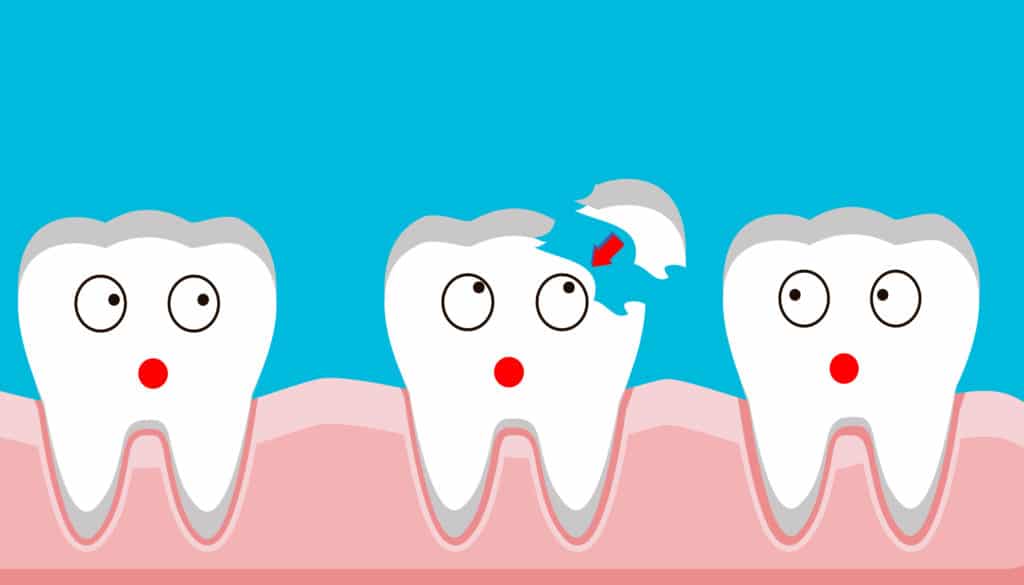 How Much to Repair a Chipped Tooth: A Comprehensive Guide