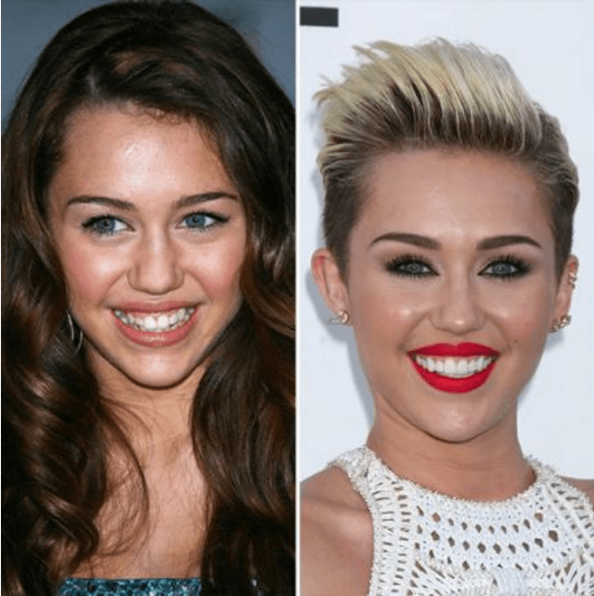 Celebrities with Veneers