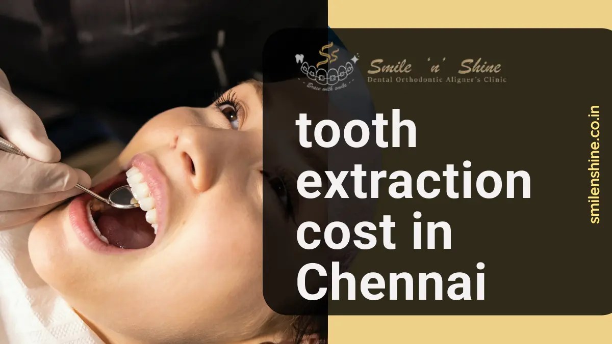 Tooth Extraction Cost in Chennai 100 Best Care
