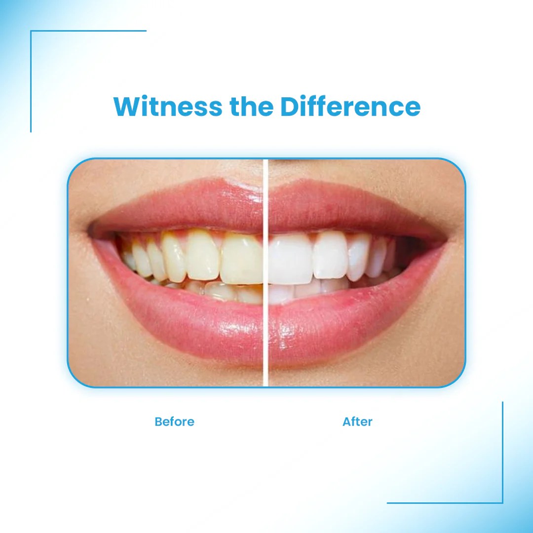 Aligner Cleaner + Whitener Multipurpose Cleaning & Whitening Foam fo