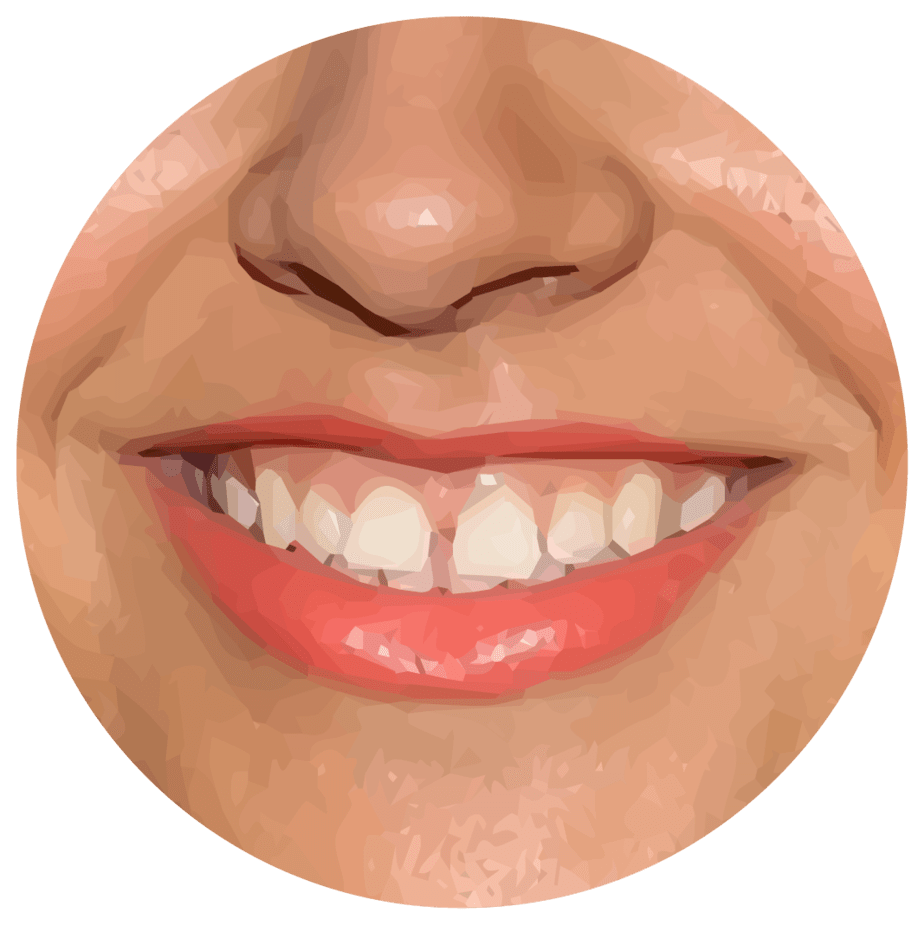 Best Ways to Correct Teeth Spacing in Adults Smile Prep