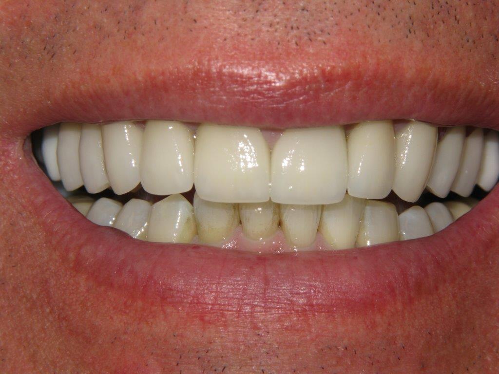 Gallery Dentist in Indianapolis, IN