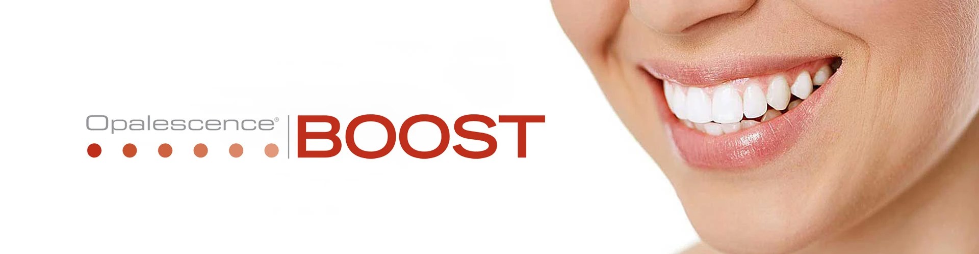 Opalescence Boost InOffice Whitening Smiles by Natasha